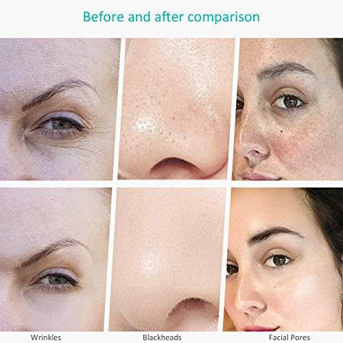 Facial Skin Scrubber Facial Cleansing Brush Blackhead Remover Instrument Deep...