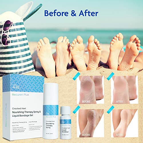 Recuren Plus Cracked Feet & Hands Solution Nourishing Therapy Spray & Liquid ...