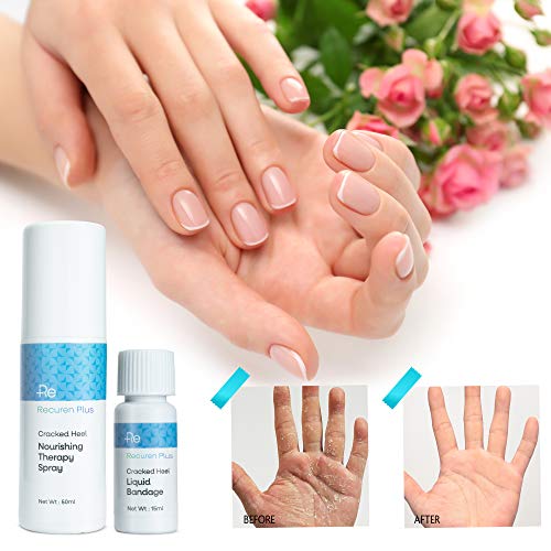 Recuren Plus Cracked Feet & Hands Solution Nourishing Therapy Spray & Liquid ...