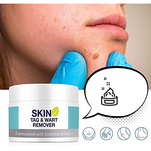 Skin Tag Remover, Warts & Mole Remover Cream, Skin Tags Dry and Fall Away, Sk...