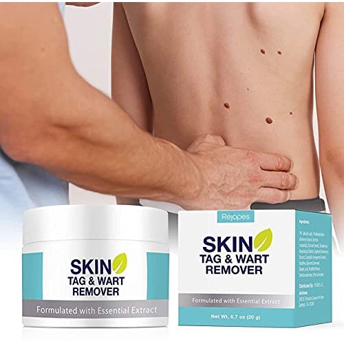 Skin Tag Remover, Warts & Mole Remover Cream, Skin Tags Dry and Fall Away, Sk...