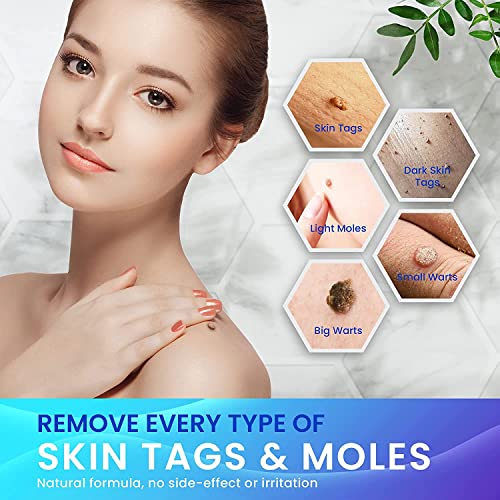Skin Tag Remover, Warts & Mole Remover Pen, Skin Tags Dry and Fall Away, Skin...