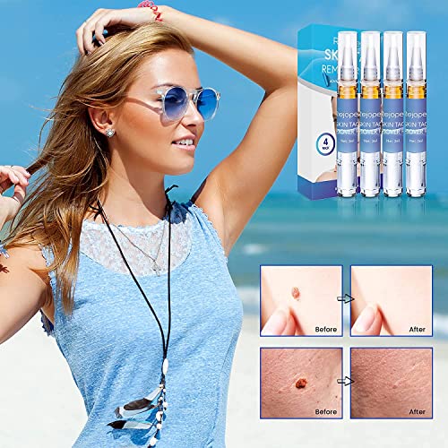 Skin Tag Remover, Warts & Mole Remover Pen, Skin Tags Dry and Fall Away, Skin...
