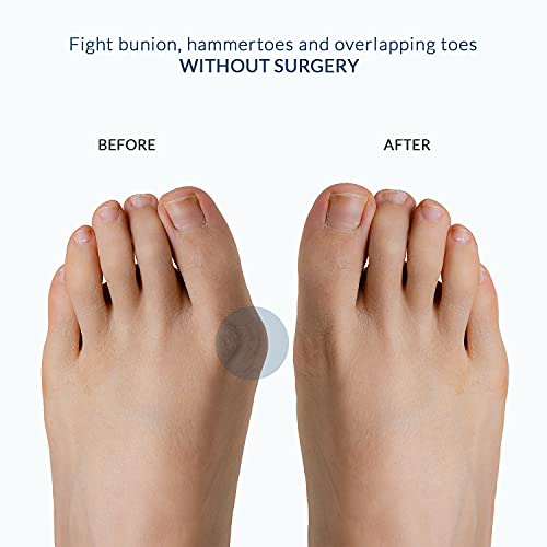 Anatomical Gel Toe Separators, Spreaders & Straighteners- Relieves Foot Pain ...