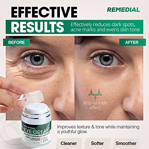 Eye Cream for Dark Circles Wrinkles Puffiness and Bags Under Eyes – Anti-Agin...