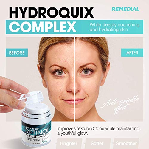Retinol Cream for Face – Facial Moisturizer with Hyaluronic Acid and Collagen...