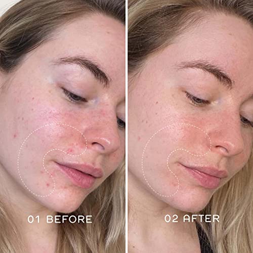 REN Clean Skincare Glow Tonic - Daily Facial Brightening - Exfoliate, Hydrate...