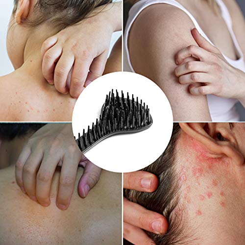 RENOOK Back Scratchers, Area Needling and Naturally Curved Handle, Labor-Savi...