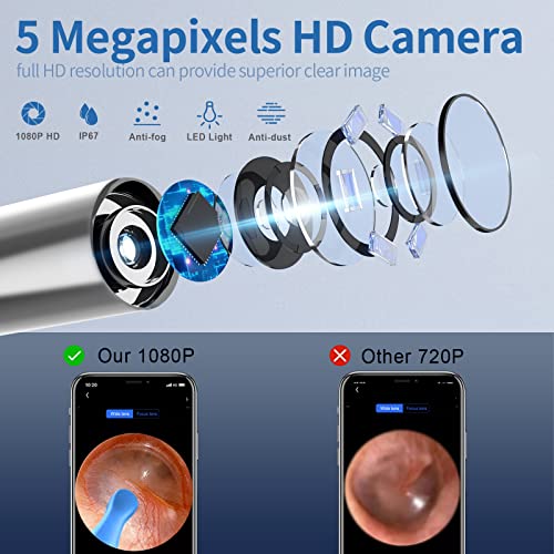 Ear Wax Removal,Ear Wax Removal Tool with 6 Pcs Ear Set,Ear Wax Removal Tool ...