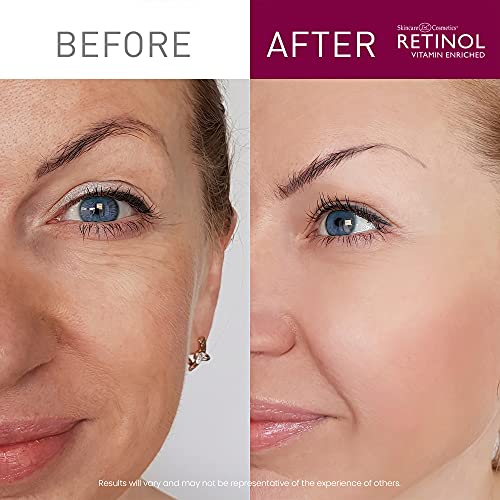 Retinol Anti-Aging Starter Kit – The Original Retinol For a Younger Look – [4...