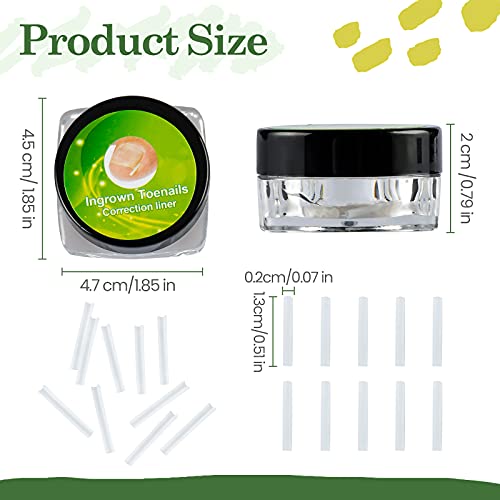 RMISODO 60 Pieces Ingrown Toenail Corrector Strips, Professional Toenail Corr...