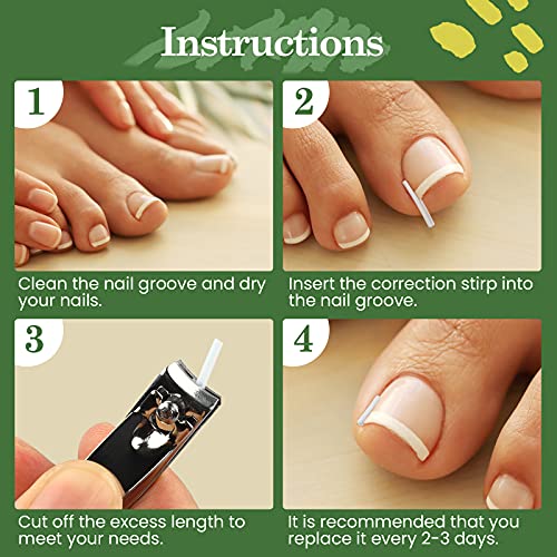RMISODO 60 Pieces Ingrown Toenail Corrector Strips, Professional Toenail Corr...