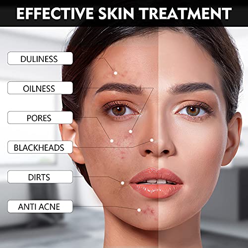 Blackhead Remover Mask, 4-in-1 Peel Off Charcoal Face Mask,Vitamin C Serum,Ex...