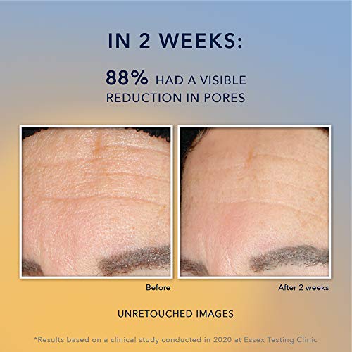 RoC Multi Correxion Revive + Glow Gel Facial Cleanser With Vitamin C, & Glyco...