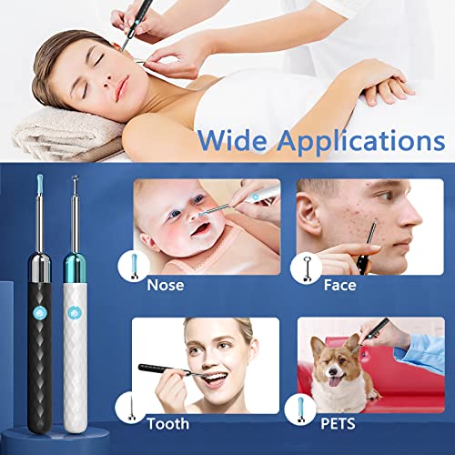 Rocason Ear Wax Removal Tool, Earwax Cleaner Kit with 1080P Camera, Ear Candl...