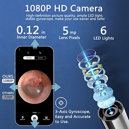 Rocason Ear Wax Removal Tool, Earwax Cleaner Kit with 1080P Camera, Ear Candl...