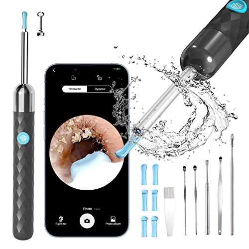 Rocason Ear Wax Removal Tool, Earwax Cleaner Kit with 1080P Camera, Ear Candl...
