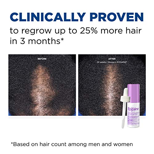Rogaine Women's 2% Minoxidil Topical Solution for Womens Hair Thinning and Lo...