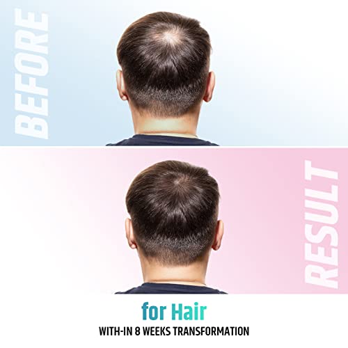 Derma Roller Beard Growth Kit Facial Skin Care Tools Skincare Hair Beard Face...