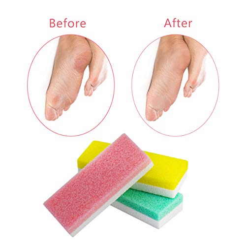 Foot Pumice Stone for Feet, 2 in 1 Double Sided Hard Skin Callus Remover Scru...