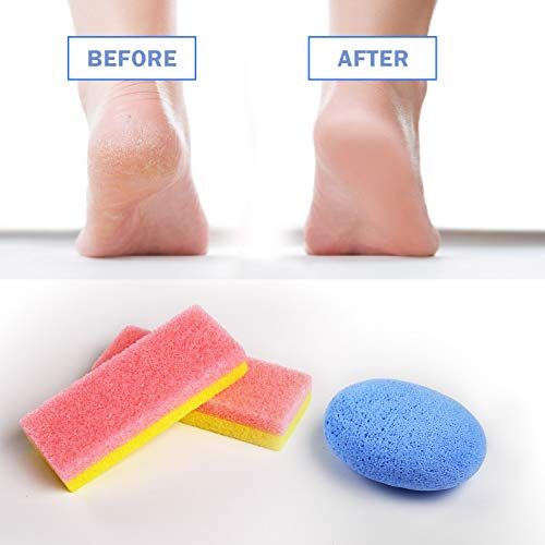 Foot Pumice Stone for Feet Set, Includes 2 PCS Pedicure Glass Stone for Heavy...