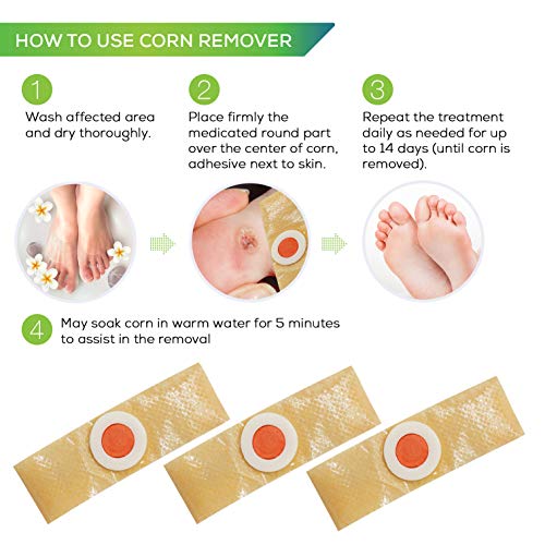 Corn Remover, 84 Corn Remover Pads, Toe Corn and Callus Removal, Corn Treatme...