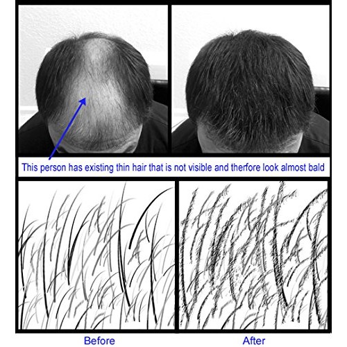 SPRAYER APPLICATOR with Thickening hair Fibers for Hair Loss Beard Mustach Gr...