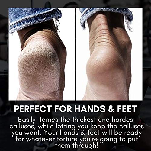SandBar - Original Callus Remover | The Ultimate Callus Tool for Hands and Fe...