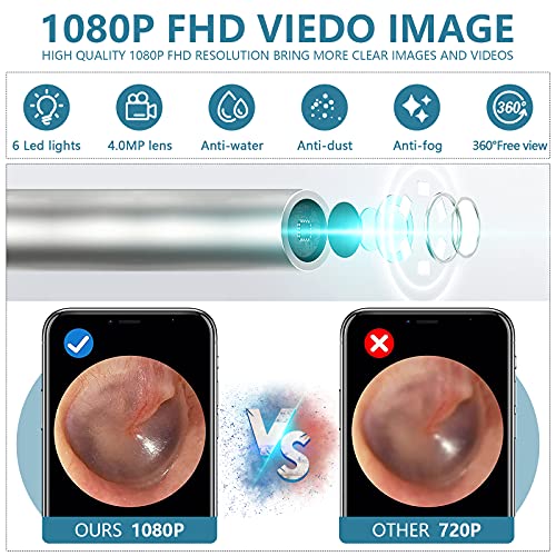 SATUNRYI Ear Wax Removal Tool Cleaner with Camera 1080P HD WiFi Endoscope 6 E...