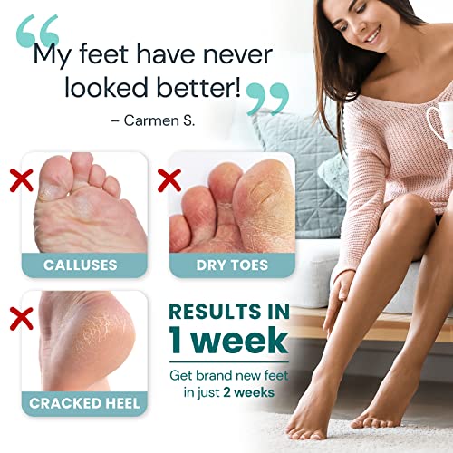 Foot Peel Exfoliating Mask (2 Pairs) for Soft Feet and Exfoliant Gel Peels Aw...