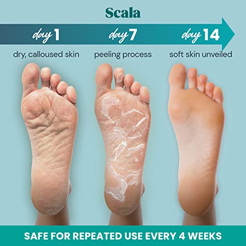 Foot Peel Exfoliating Mask (2 Pairs) for Soft Feet and Exfoliant Gel Peels Aw...