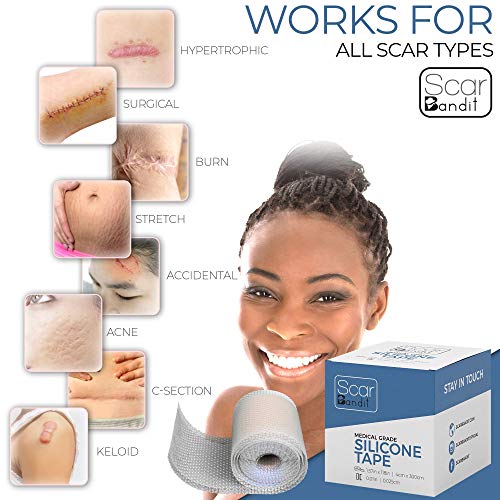 Scarbandit Silicone Tape - Shower Proof Bandage Strips - Skin Safe, Medical G...