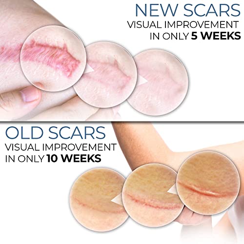 Scarbandit Silicone Tape - Shower Proof Bandage Strips - Skin Safe, Medical G...