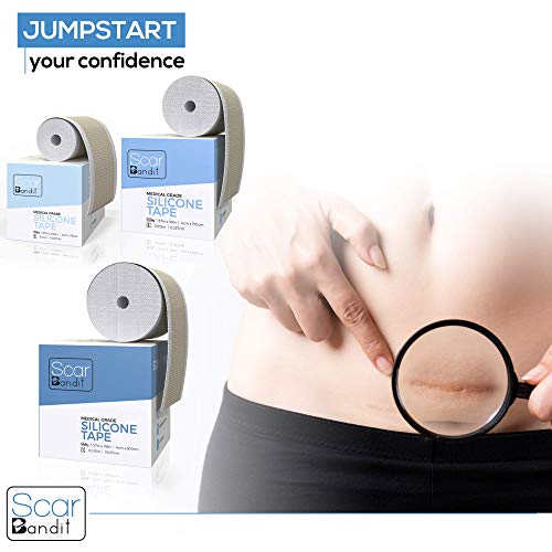 Silicone Scar Sheets - Keloid Scar Removal Treatment. Medical Grade Scar Patc...