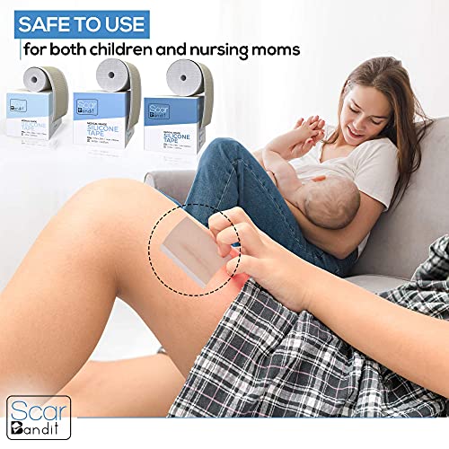 Silicone Scar Sheets - Keloid Scar Removal Treatment. Medical Grade Scar Patc...