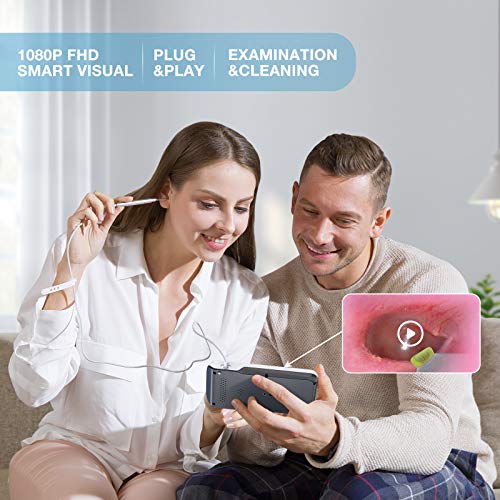ScopeAround Ear Wax Removal Camera with 4.5" IPS Screen, 1920x1080 FHD Smart ...
