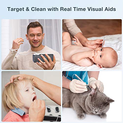 ScopeAround Ear Wax Removal Camera with 4.5" IPS Screen, 1920x1080 FHD Smart ...