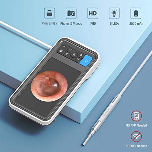 ScopeAround Ear Wax Removal Camera with 4.5" IPS Screen, 1920x1080 FHD Smart ...