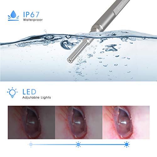 ScopeAround Ear Wax Removal Camera with 4.5" IPS Screen, 1920x1080 FHD Smart ...