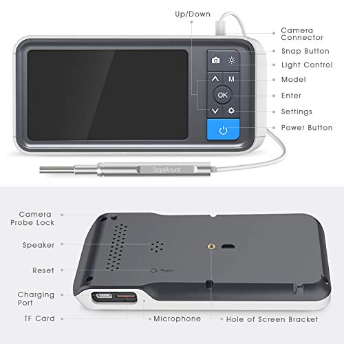 ScopeAround Ear Wax Removal Camera with 4.5" IPS Screen, 1920x1080 FHD Smart ...
