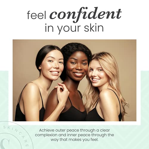 Sdara Skincare Derma Roller Version 2.0-0.25 mm Microneedle Roller for Face w...