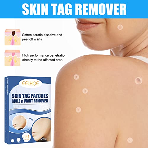 144 Pcs Skin Tag Remover Patches, Wart Remover, Natural Ingredients for Safe ...