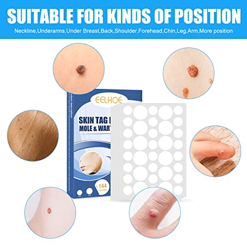 144 Pcs Skin Tag Remover Patches, Wart Remover, Natural Ingredients for Safe ...