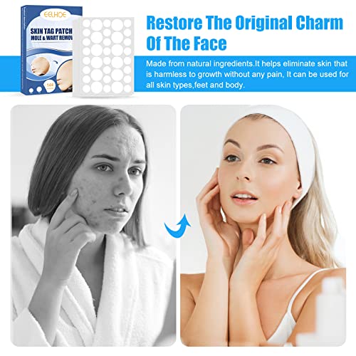 144 Pcs Skin Tag Remover Patches, Wart Remover, Natural Ingredients for Safe ...
