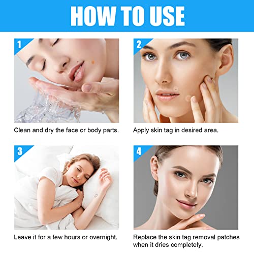 144 Pcs Skin Tag Remover Patches, Wart Remover, Natural Ingredients for Safe ...