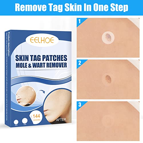 144 Pcs Skin Tag Remover Patches, Wart Remover, Natural Ingredients for Safe ...