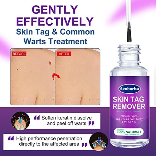 Skin Tag Remover,Extra Strength Skin tag Removal Serum,Made of Natural Plant ...