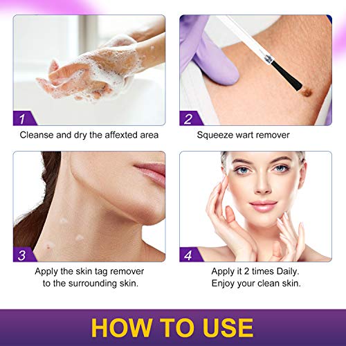Skin Tag Remover,Extra Strength Skin tag Removal Serum,Made of Natural Plant ...