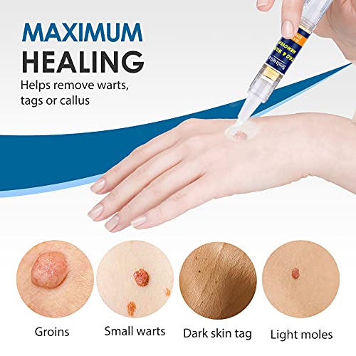 Skin Tag Remover, Extra Strength Skin tag Removal, Wart Remover, Tag Dry and ...