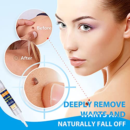 Skin Tag Remover, Extra Strength Skin tag Removal, Wart Remover, Tag Dry and ...